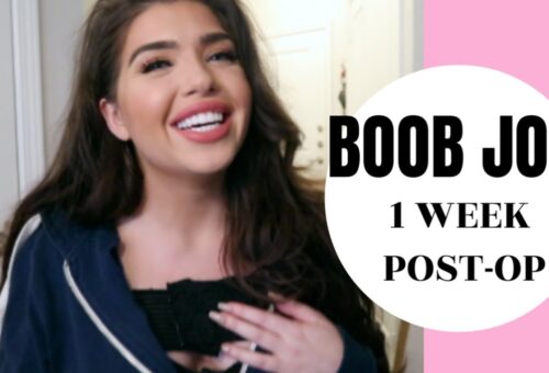 1 WEEK POST OP BOOB JOB | Breast Augmentation Recovery