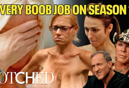 EVERY Boob Job on Season 2: Ruptured Implants, Infections and More (Compilation) | Botched | E!
