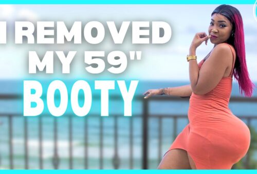 I Spent $100k To Remove My Illegal 59″ Booty | HOOKED ON THE LOOK