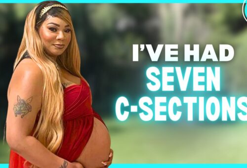 I’ve Had 7 C-Sections – Now I’m A Mom-Of-11 | MY EXTRAORDINARY FAMILY