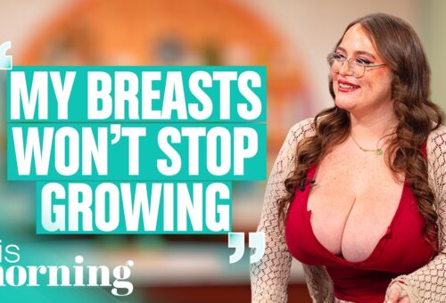 ‘My Size 30U Boobs Weigh 27KG and Will Never Stop Growing!’ | This Morning